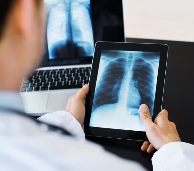 best digital X ray in Noida